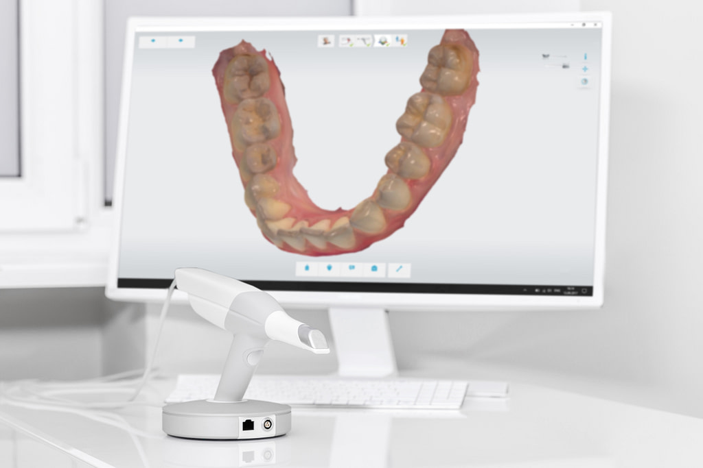 Scanner und 3D Druck - Praxis-Chalet